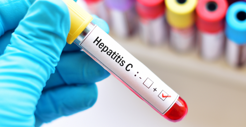 Hepatit C-nin yeni müalicə metodu çıxdı